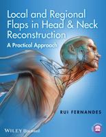 Local and Regional Flaps in Head and Neck Reconstruction: A Practical Approach 1118340337 Book Cover