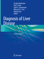 Diagnosis of Liver Disease 9811368058 Book Cover