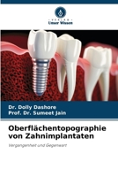 Oberflächentopographie von Zahnimplantaten (German Edition) 6209448917 Book Cover
