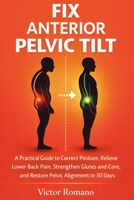 Fix Anterior Pelvic Tilt: A Practical Guide to Correct Posture, Relieve Lower Back Pain, Strengthen Glutes and Core, and Restore Pelvic Alignment in 30 Days 1807655504 Book Cover