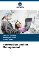 Perforation und ihr Management 6205321203 Book Cover