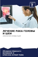 ЛЕЧЕНИЕ РАКА ГОЛОВЫ И ШЕИ 6206104907 Book Cover