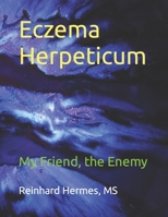 Eczema Herpeticum: My Friend, the Enemy 1798593475 Book Cover