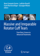 Massive and Irreparable Rotator Cuff Tears: From Basic Science to Advanced Treatments 3662611643 Book Cover