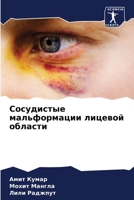 Сосудистые мальформаци&# 6207434552 Book Cover