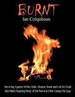 Burnt: Surviving Against All the Odds - Beaten, Burnt and Left for Dead. One Man's Inspiring Story of His Survival After Losing His Legs 1902578287 Book Cover