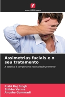 Assimetrias faciais e o seu tratamento (Portuguese Edition) 6630396804 Book Cover