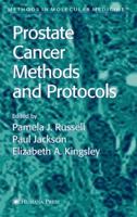 Prostate Cancer Methods and Protocols 1489938508 Book Cover