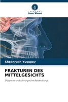 Frakturen Des Mittelgesichts (German Edition) 6207894219 Book Cover