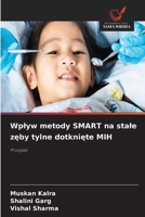 Wplyw metody SMART na stale zęby tylne dotknięte MIH 663034572X Book Cover