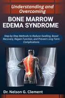 UNDERSTANDING AND OVERCOMING BONE MARROW EDEMA SYNDROME: Step-by-Step Methods to Reduce Swelling, Boost Recovery, Regain Function, and Prevent Long-Term Complications B0FSR8SCRV Book Cover