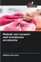 Metodi non invasivi nell'ortodonzia accelerata (Italian Edition) 6209449522 Book Cover
