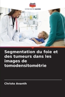 Segmentation du foie et des tumeurs dans les images de tomodensitométrie (French Edition) 6207739043 Book Cover