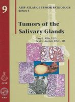 Tumors Of The Salivary Glands (Atlas Of Tumor Pathology 3rd Series) 1881041263 Book Cover