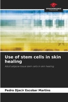 Use of stem cells in skin healing 6207742699 Book Cover