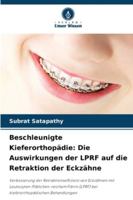 Beschleunigte Kieferorthopädie: Die Auswirkungen der LPRF auf die Retraktion der Eckzähne 3639865723 Book Cover