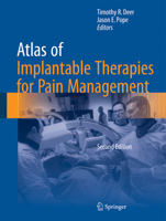 Atlas of Implantable Therapies for Pain Management 1493939491 Book Cover