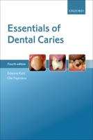 Essentials of Dental Caries: The Disease and Its Management 0198529783 Book Cover