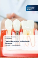 Dental Implants in Diabetic Patients B0FKS4HJPT Book Cover