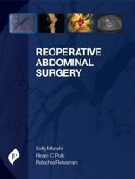 Reoperative Abdominal Surgery 1907816550 Book Cover