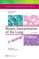 Biopsy Interpretation of the Lung (Biopsy Interpretation Series) 1975240677 Book Cover