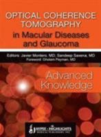 Optical Coherence Tomography in Macular Diseases and Glaucoma: Advanced Knowledge 9962678447 Book Cover