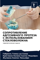 СОПРОТИВЛЕНИЕ АДГЕЗИВНОГО ПРОТЕЗА С ИСПОЛЬЗОВАНИЕМ СТЕКЛОВОЛОКНА: терапевтические задачи 6203688789 Book Cover