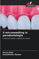 Il microneedling in parodontologia 6630285905 Book Cover