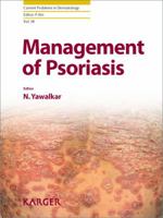 Management of Psoriasis 3805591519 Book Cover