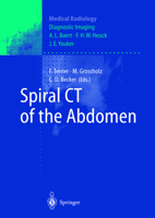 Spiral CT of the Abdomen 3540422919 Book Cover