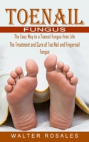 Toenail Fungus: The Easy Way to a Toenail Fungus-free Life 1774854708 Book Cover