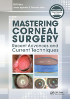 Surgical Maneuvers on the Cornea 1617116408 Book Cover