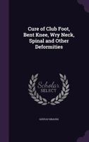 Cure of Club Foot, Bent Knee, Wry Neck, Spinal and Other Deformities 1359309918 Book Cover