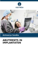 Abutments in Implantaten (German Edition) 6208221110 Book Cover