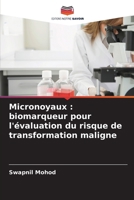 Micronoyaux: biomarqueur pour l'évaluation du risque de transformation maligne (French Edition) 6207004191 Book Cover