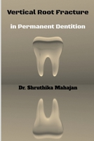 Vertical Root Fracture in Permanent Dentition B0B59M62QF Book Cover