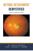 Retinal Detachment Demystified: Doctor's Secret Guide B0CKYHGZTR Book Cover