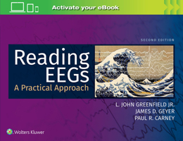 Reading EEGs: A Practical Approach 1975121198 Book Cover