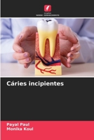 Cáries incipientes (Portuguese Edition) 6207755022 Book Cover