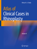 Atlas of Clinical Cases in Rhinoplasty: Volume II 3031122704 Book Cover