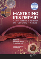 Mastering Iris Repair: A Video Textbook of Iris Repair and Pupilloplasty Techniques 1630917265 Book Cover