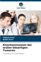 Knocheninvasion bei oralen bösartigen Tumoren (German Edition) 6207689208 Book Cover