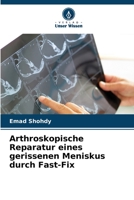 Arthroskopische Reparatur eines gerissenen Meniskus durch Fast-Fix 6204703358 Book Cover