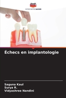 Échecs en implantologie 6206307093 Book Cover