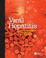 Viral Hepatitis: Scientific Basis and Clinical Management 1405130059 Book Cover