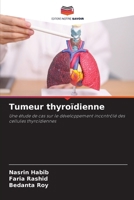 Tumeur thyroïdienne (French Edition) 6207732448 Book Cover