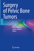 Surgery of Pelvic Bone Tumors 3030770060 Book Cover