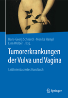 Tumorerkrankungen Der Vulva Und Vagina: Leitlinienbasiertes Handbuch 3662566354 Book Cover