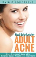 Real Solutions for Adult Acne: Cure Hormonal Acne with Science-Backed Treatments that Work 1945410000 Book Cover