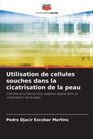 Utilisation de cellules souches dans la cicatrisation de la peau (French Edition) 6207742710 Book Cover